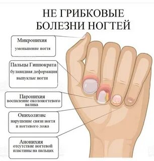Почему болят пальцы на руках и ногах