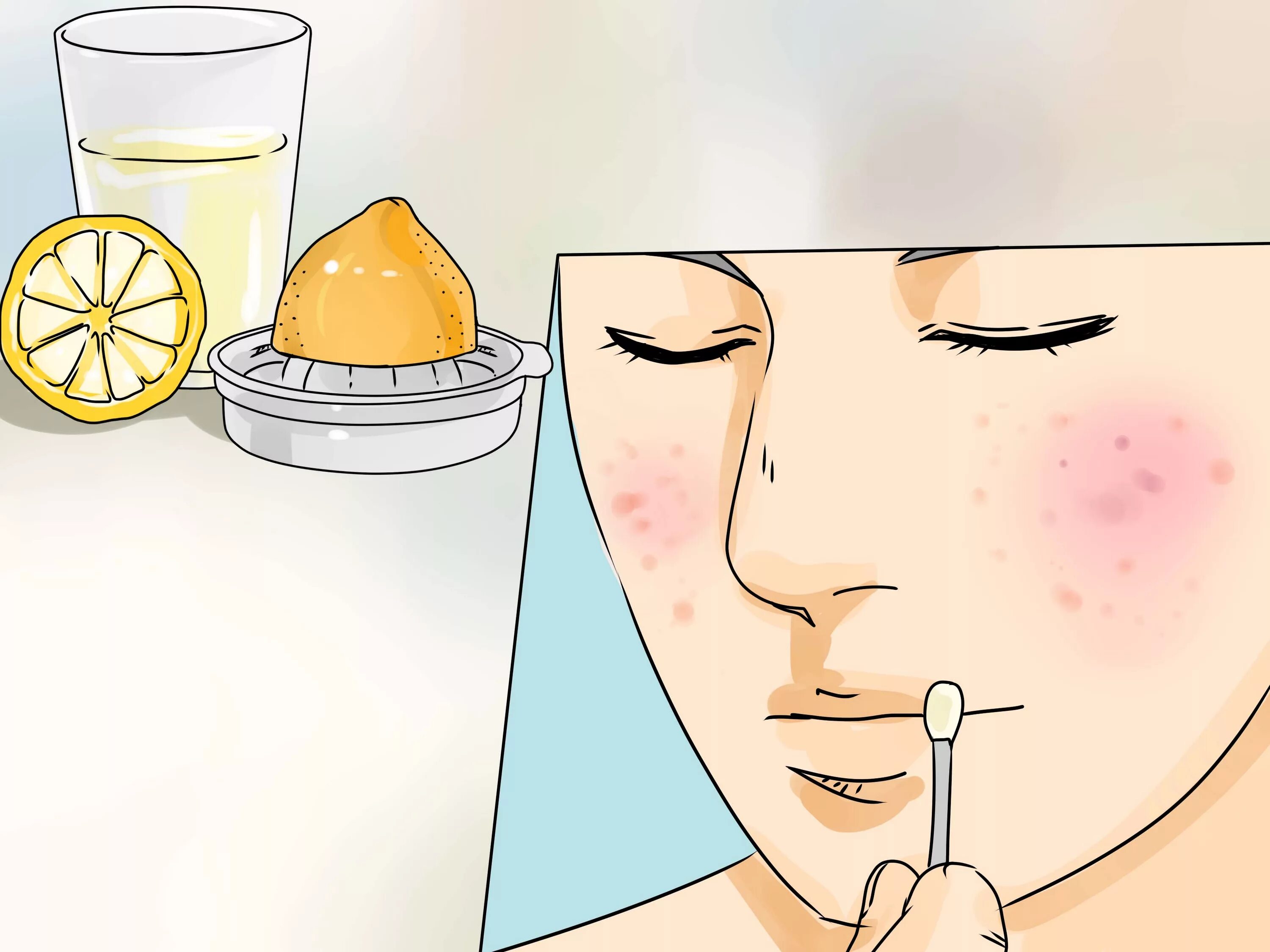 3 Cara untuk Menghentikan Atau Mengobati Jerawat - wikiHow
