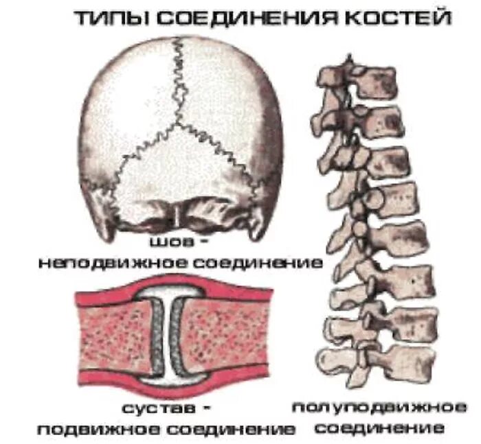 Типы соединения костей скелета. Неподвижный Тип соединения костей. Типы соединения костей человека. Неподвижное соединение костей.