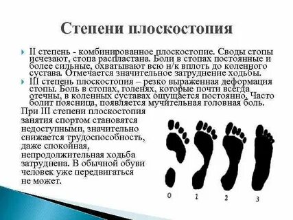 Как увеличить степень плоскостопия