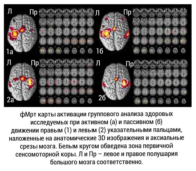 Сколько потребляет мозг. Активность мозга. Энергопотребление мозга. Потребление калорий мозгом. Энергопотребление мозга человека.