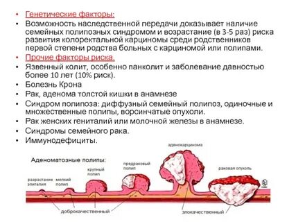 Синдромы полипоза