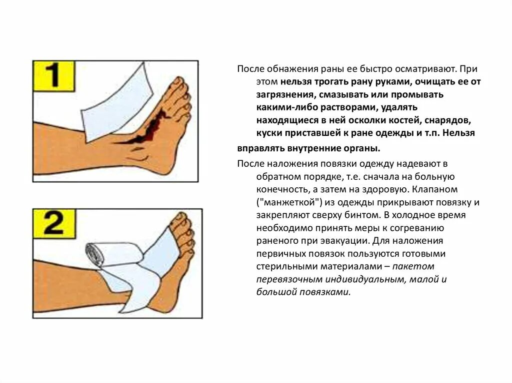 Наложение асептической повязки. Наложение асептической повязки при ожогах. Наложить стерильную повязку. Техника наложения стерильной повязки. Наложение асептической повязки на рану