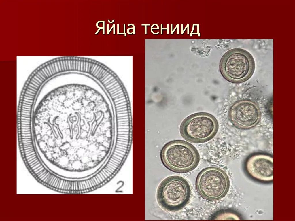Яйцо (онкосфера) тениид. Яйца бычьего цепня микроскоп. Яйца онкосферы тениид. Яйца свиного цепня микроскоп. Яйцо с онкосферой