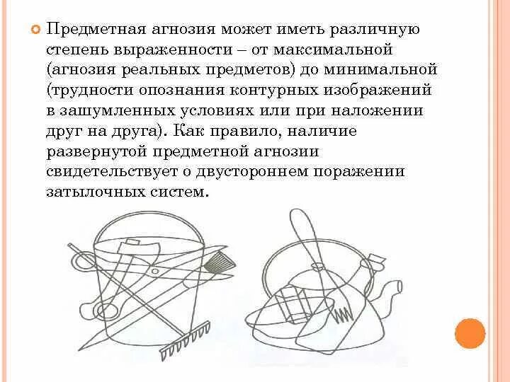 Предметная зрительная агнозия. Предметная агнозия симптомы. Виды зрительного гнозиса. Предметная зрительная агнозия. Предметная агнозия симптомы.