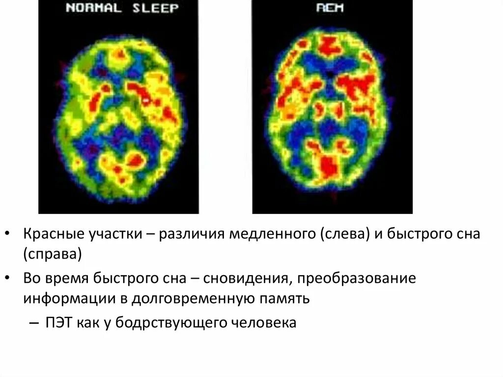 Деятельность мозга во сне. Фазы активности мозга. Активность мозга во время сна. Фазы сна и активность мозга.