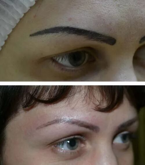Брови после пермамаментп. Перманентный макияж. Брови после ремувера. Брови после пермамаментп. Ремувер для снятия перманентного макияжа.