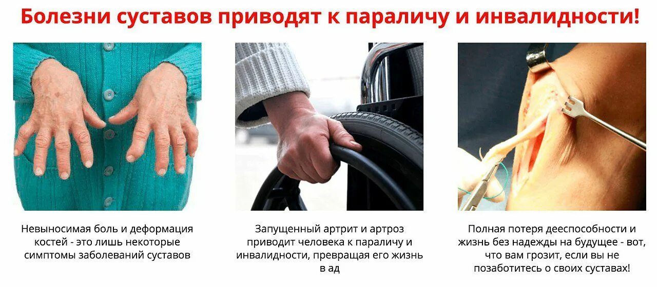 Как называется боль в костях