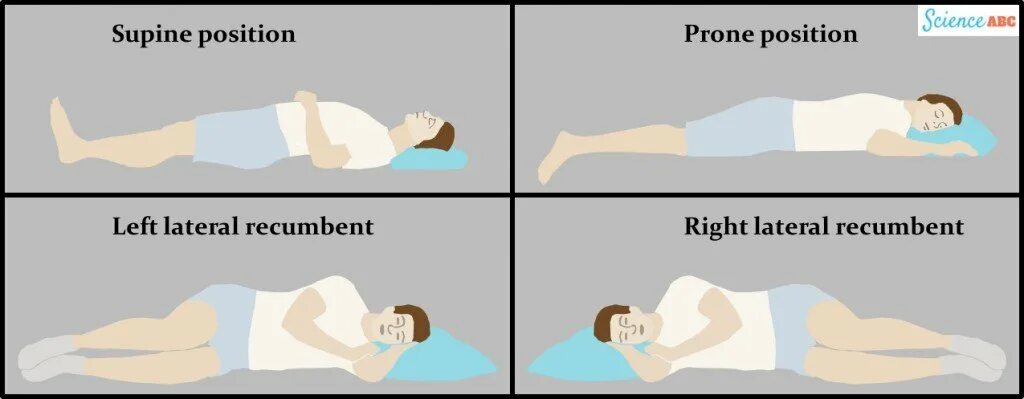Improved position. Prone позиция. supine position. lateral recumbent position. the position.