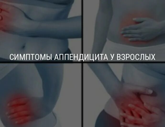 Может ли быть аппендицит без температуры. Симптомы аппендицита у женщин. признаки аппендицита у женщин. аппендикс симптомы у женщин.