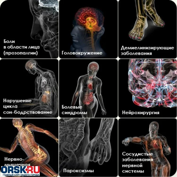 Невропатолог болезни. Заболевания нервной системы. Болезни нервной системы человека. Симптомы заболевания нервной системы. Патологии нервной системы симптомы.