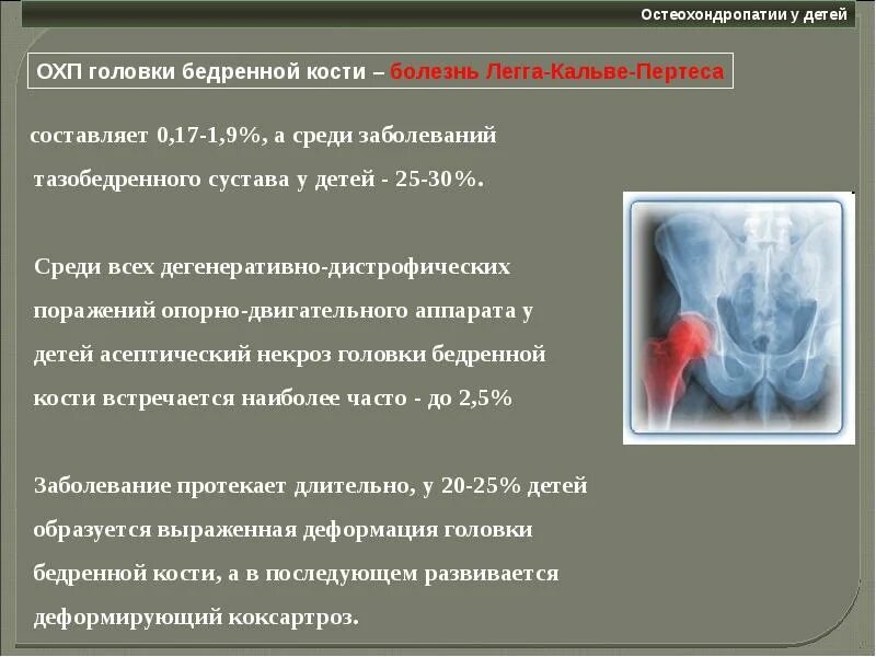 Остеохондропатии асептический некроз. Остеохондропатии Пертеса. Асептический некроз головки бедренной кости Пертеса. Остеохондропатии Легга-Кальве-Пертеса. Асептический некроз головки мкб 10