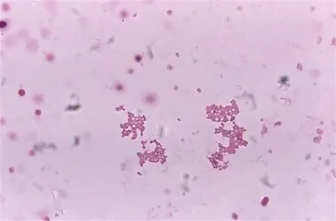 Megasphaera spp veillonella spp dialister spp