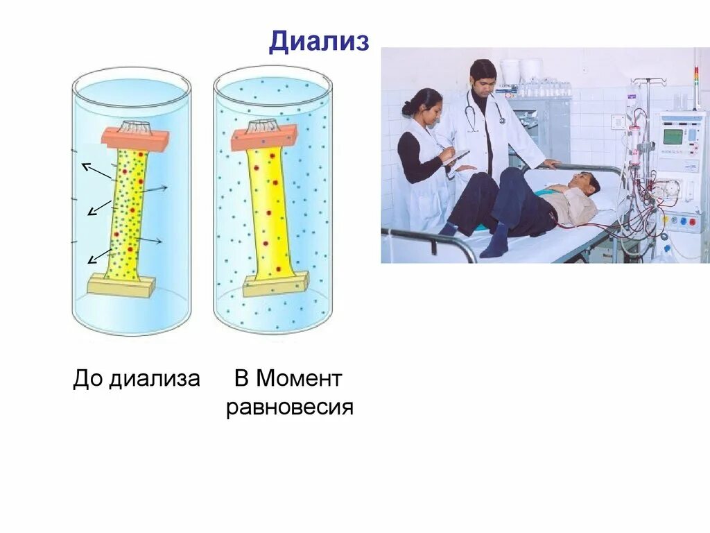 Диализ белков. Диализ схема химия. Диализ коллоидная химия. Диализ коллоидных растворов. Метод диализа в химии.