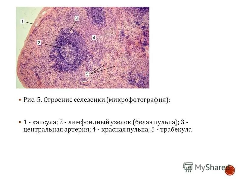 Красная пульпа селезенки