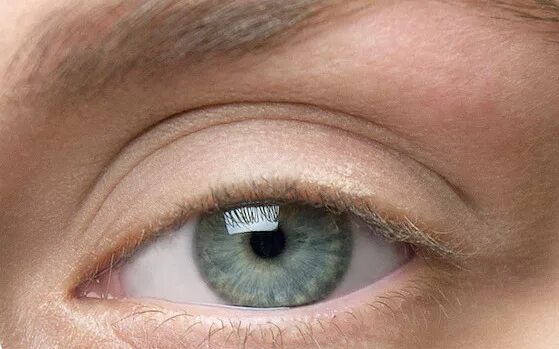 тяжелое верхнее веко. веки нависают на глаза. нависшее веко. глаза с большим верхним веком. глаза с нависшим веком.