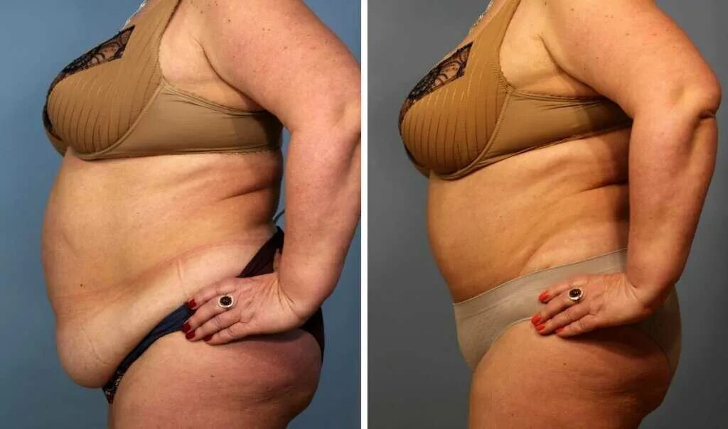 пухлые руки