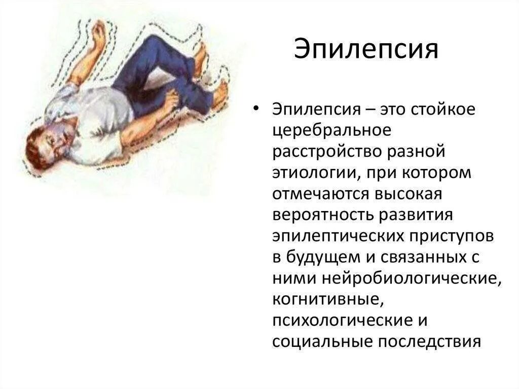 Судороги лечение у взрослых. Эпилептические припадки болезни. эпилептический припадок симптомы у детей. эпилепсия тонико-клонические судороги. эпилепсия судорожные симптомы.