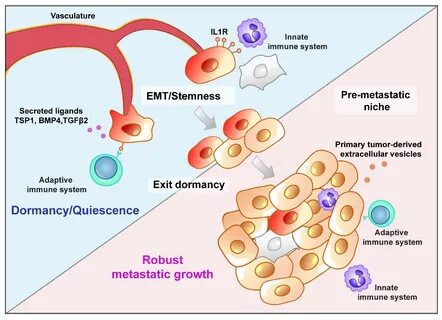 Metastasis