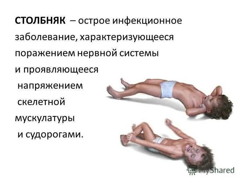 Судороги при давлении