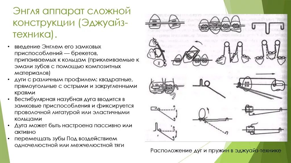 Аппарат Энгля конструкция. Эджуайз техника. Эджуайс техника ортодонтия. Каковы составные части современной Эджуайз-техники.. Техники промтинга