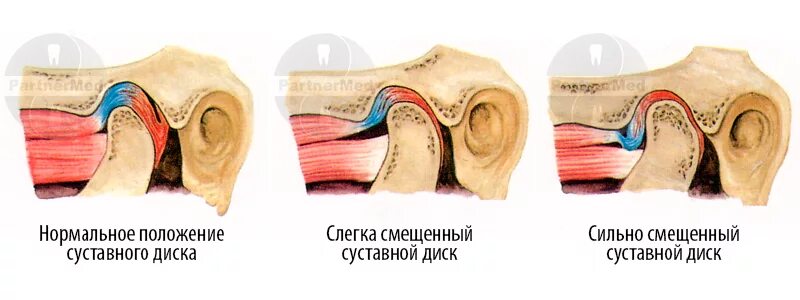 Хрустит челюсть к какому врачу обращаться