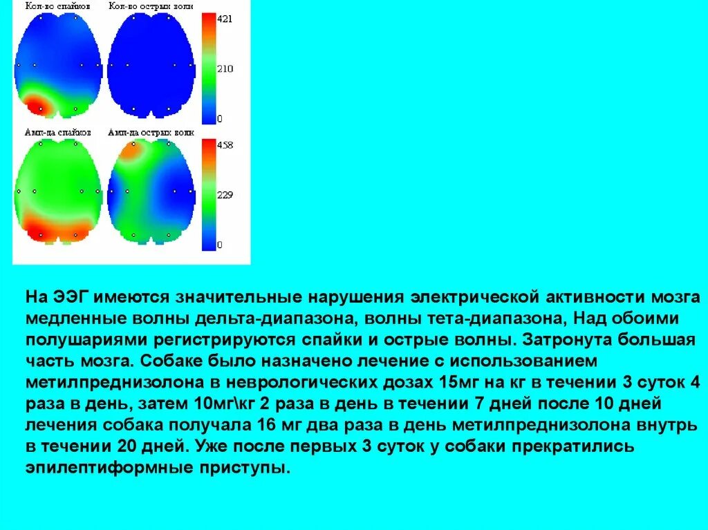 ЭЭГ спайки и острые волны. Спайк волновая активность на ЭЭГ. Острые волны на ЭЭГ. Спайк медленная волна на ЭЭГ что это. Спайк на ээг