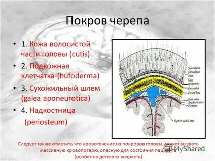 Покров черепных