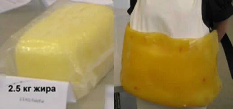Килограмм человеческого жира. Можно ли продать жир. Масло сливочное наименование. Килограмм жира стоимость. Можно ли продать жир.