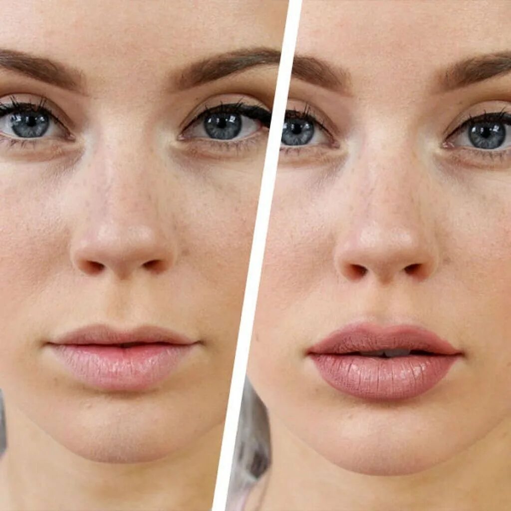 Макияж для тонких губ. Увеличение тонких губ до и после. Увеличение губ фото до и после тонкие губы.