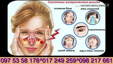 Назальная аллергия