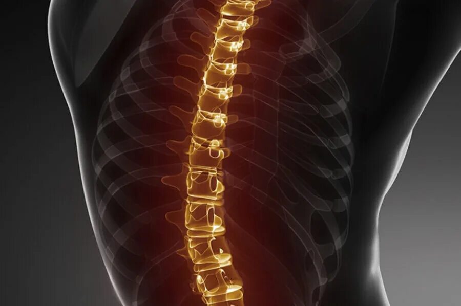 Позвоночник сколиоз грудного отдела позвоночника. Сколиоз верхнегрудного отдела позвоночника. Сколиоз нижнегрудного отдела позвоночника. Красивый позвоночник.