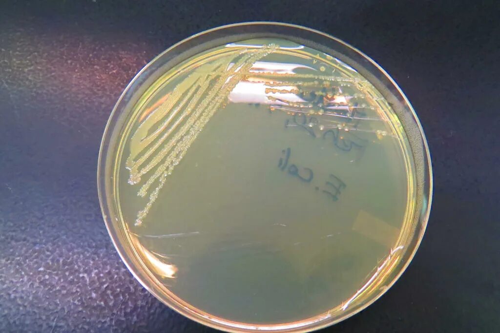 Синегнойная палочка в чашке Петри. Питательный агар (nutrient Agar) рост сальмонеллы. Резервуар синегнойной палочки. Эшерихии на питательных средах. Среда для кишечной палочки