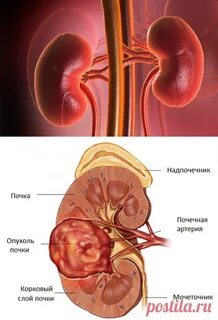 Над почками