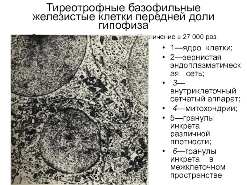 Строение аденогипофиза клеточный состав. Хромофобные эндокриноциты гипофиза. Базофильные клетки передней доли гипофиза. Базофильные клетки передней доли гипофиза. Базофильные клетки передней доли гипофиза.