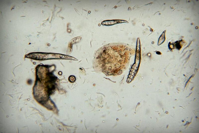 Клещи паразиты таблетки. Демодекс Канис. Демодекоз микроскопия. Демодекоз (угревая Железница).
