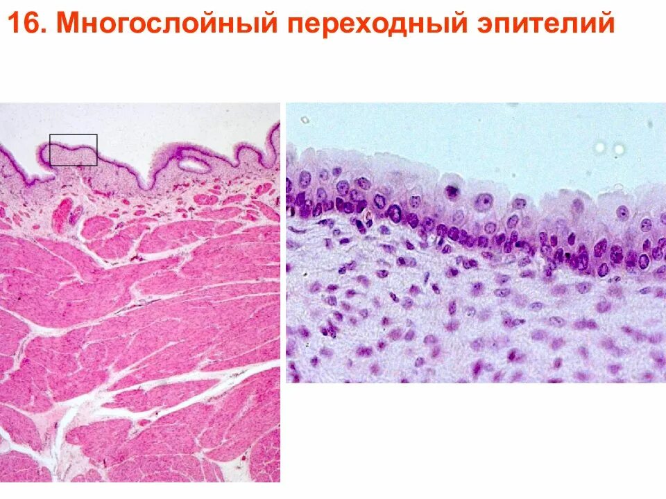 Слои переходного эпителия. Многослойный переходный эпителий препарат гистология. Эпителий мочевого пузыря гистология. Переходный эпителий гистология. Переходный эпителий уротелий препарат.