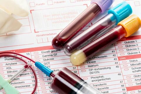 Общий анализ крови: правила сдачи