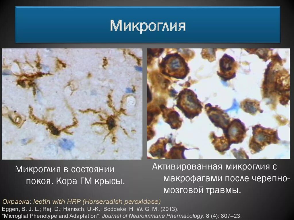 Клетки микроглии функции. Клетки микроглия гистология. амебовидная микроглия. амебоидная микроглия функции. клетки микроглии строение.