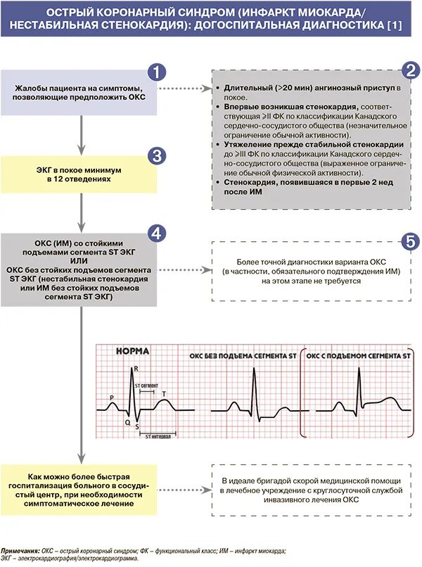 Острый коронарный синдром ЭКГ. ОИМ С подъемом St ЭКГ. Признаки Окс на ЭКГ. ЭКГ признаки коронарного синдром. Без подъема st на экг