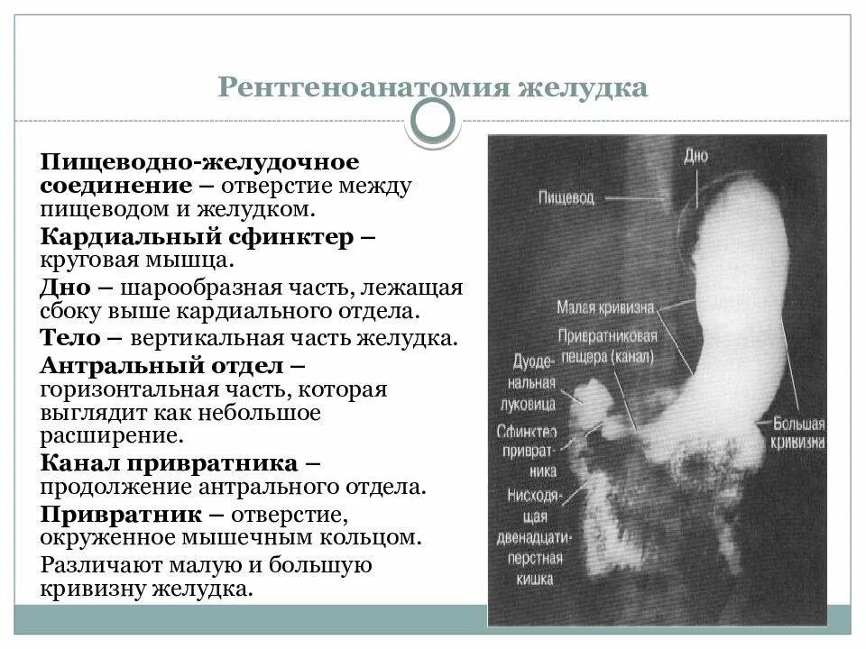 Рентгенанатомия желудка. Рентгенологические отделы желудка. Рентгеноанатомия пищевода и желудка.