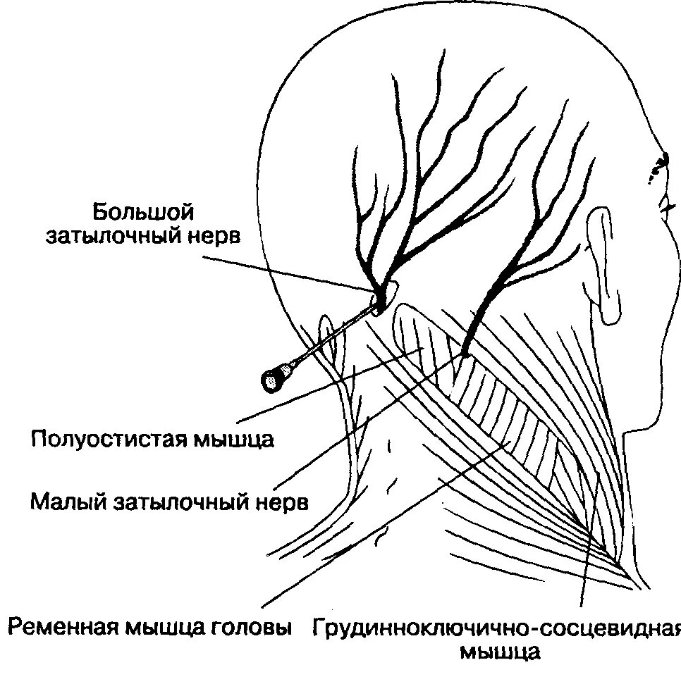 Затылок область. Зона иннервации затылочного нерва. Методика блокады большого затылочного нерва. С3 корешок и затылочный нерв. Затылочный нерв симптомы.