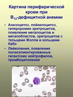 Периферические изменения