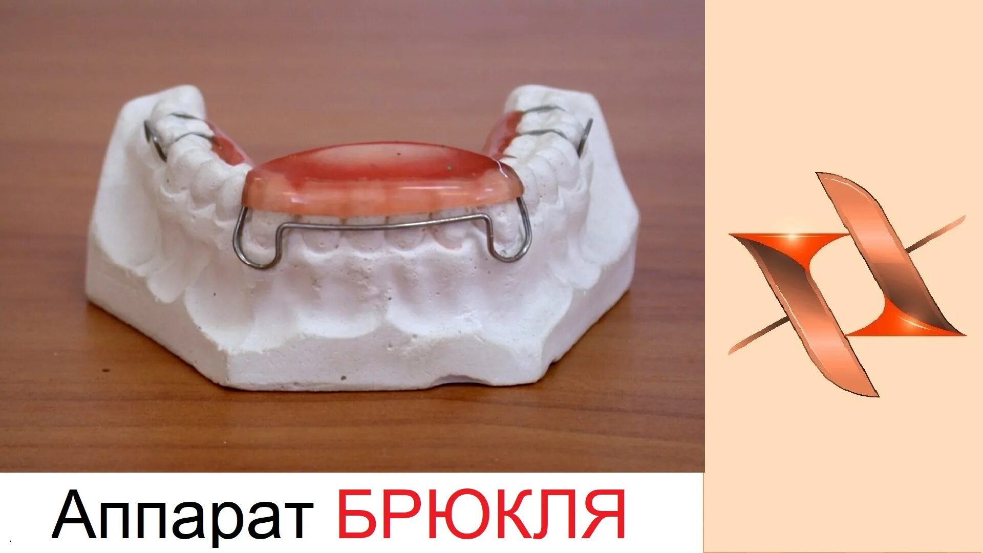 Изготовление ортодонтических