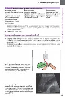 Ответы на тесты ультразвуковая диагностика