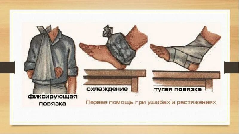 Тугая повязка при ушибе. Давящая повязка при ушибе. первая помощь при ушибах презентация.