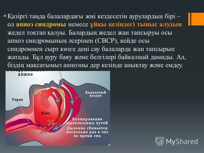апноэ. показанием к искусственной вентиляции легких является. почему человек храпит. обструктивное апноэ сна. апноэ кишлак осу.