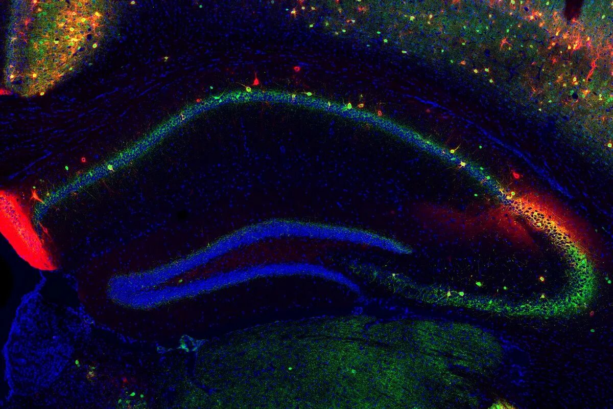 Повреждение гиппокампа. Клетки гиппокампа. Стволовые клетки гиппокампа. Гиппокамп под микроскопом. Фото гиппокампа.
