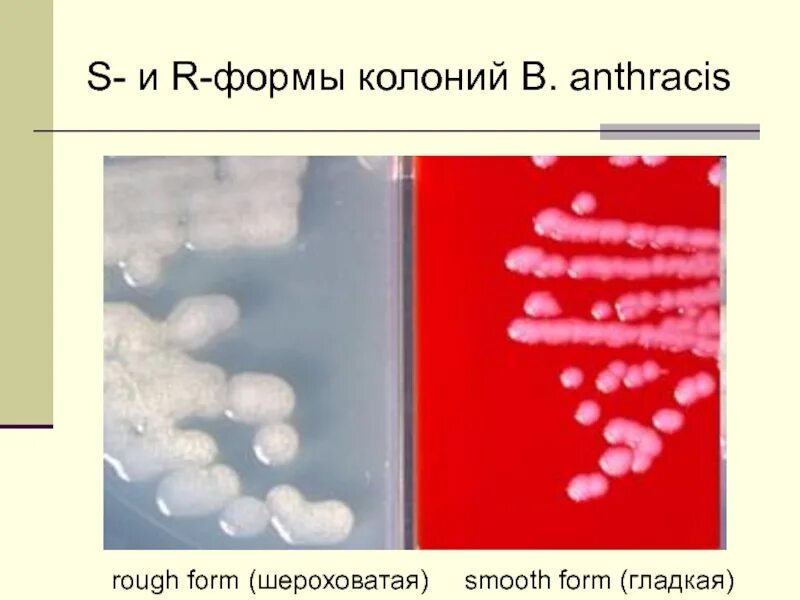 S форма бактерий. S И R формы бактерий. R форма бактерий. Колонии s и r формы. Формы колоний бактерий r s.