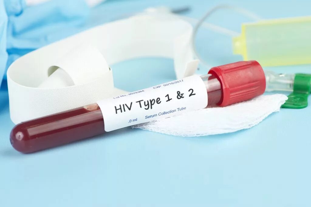 Types of HIV. Вторая кровь. HIV Type 1. Human immunodeficiency virus 1